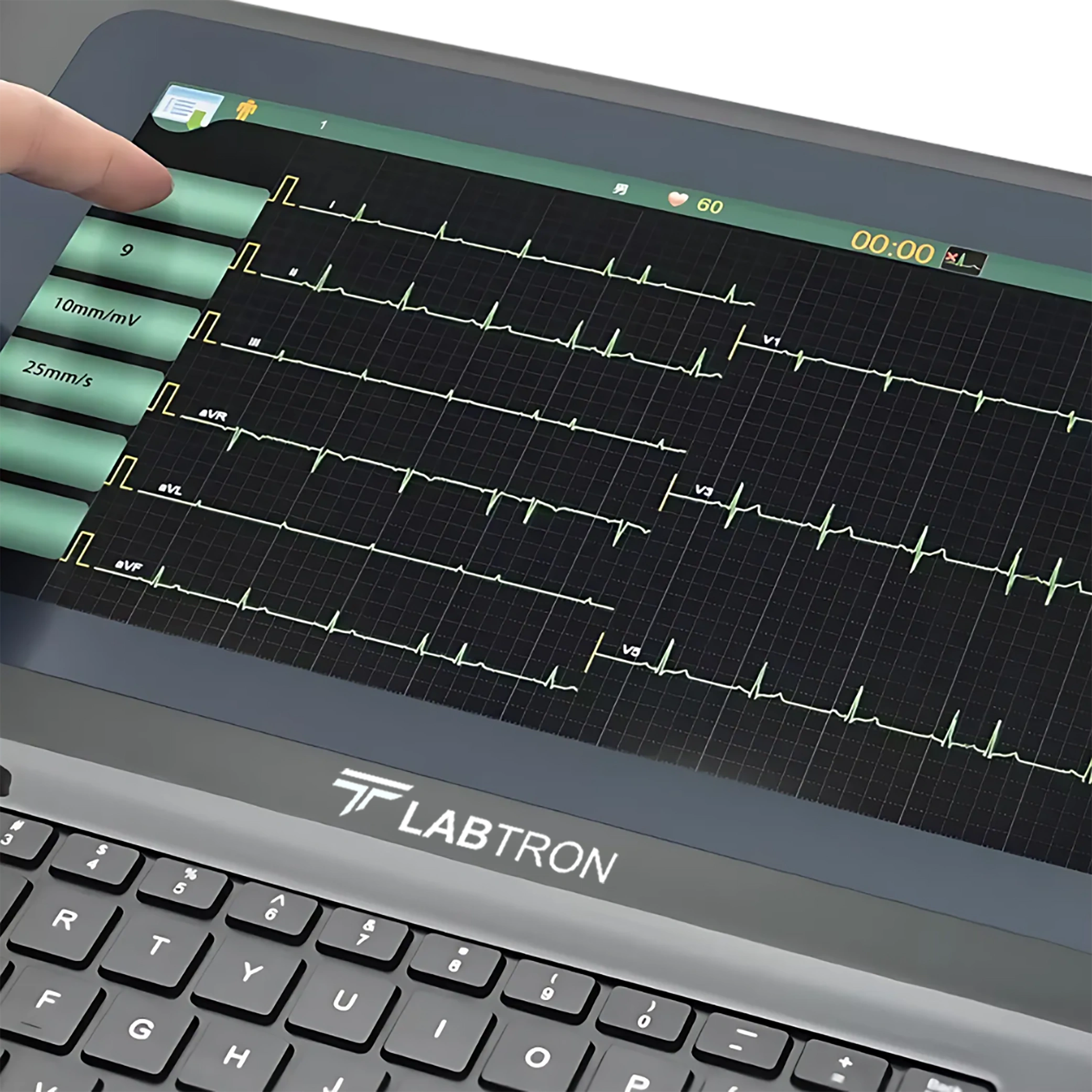 ECG Monitor LECG-D11_zoomed screen view