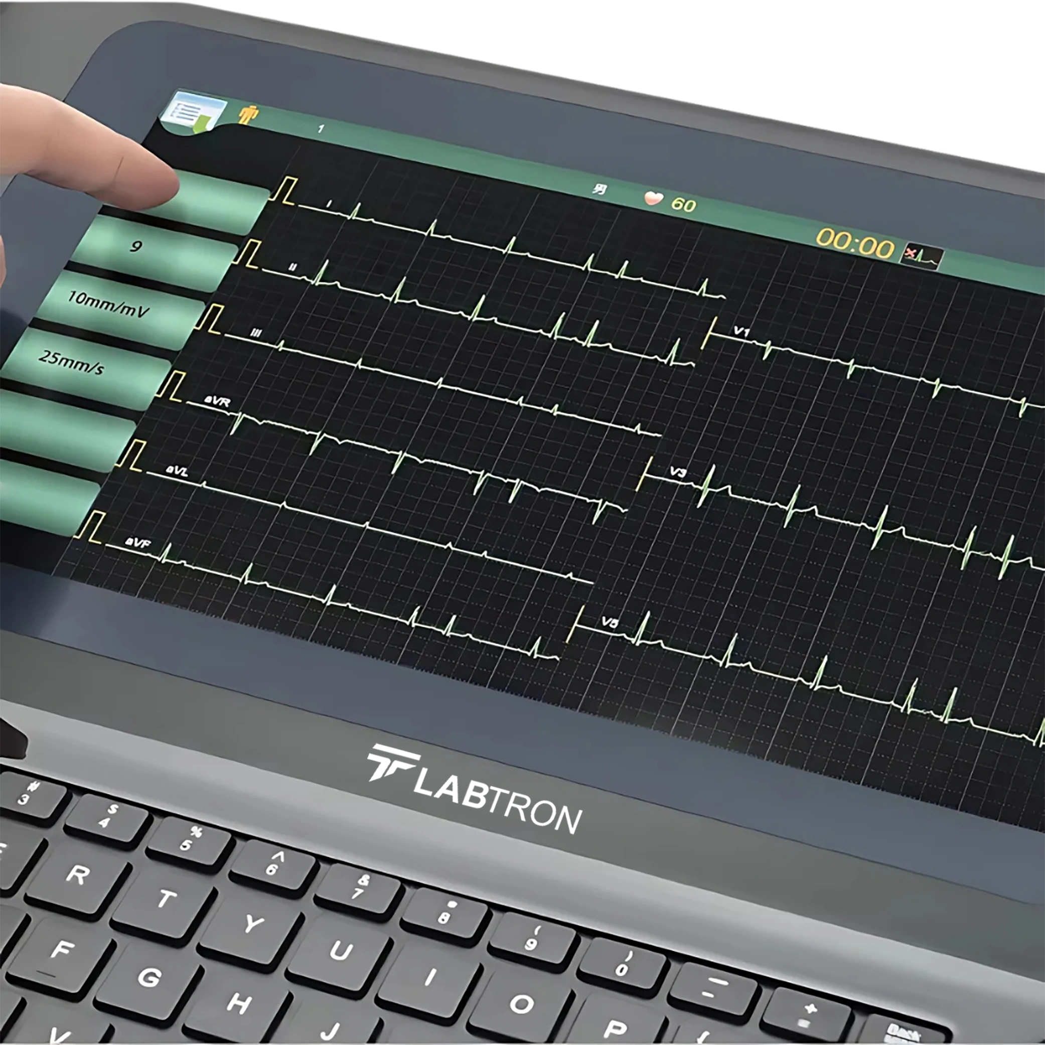 ECG Monitor LECG-D10_Zoomed screen view