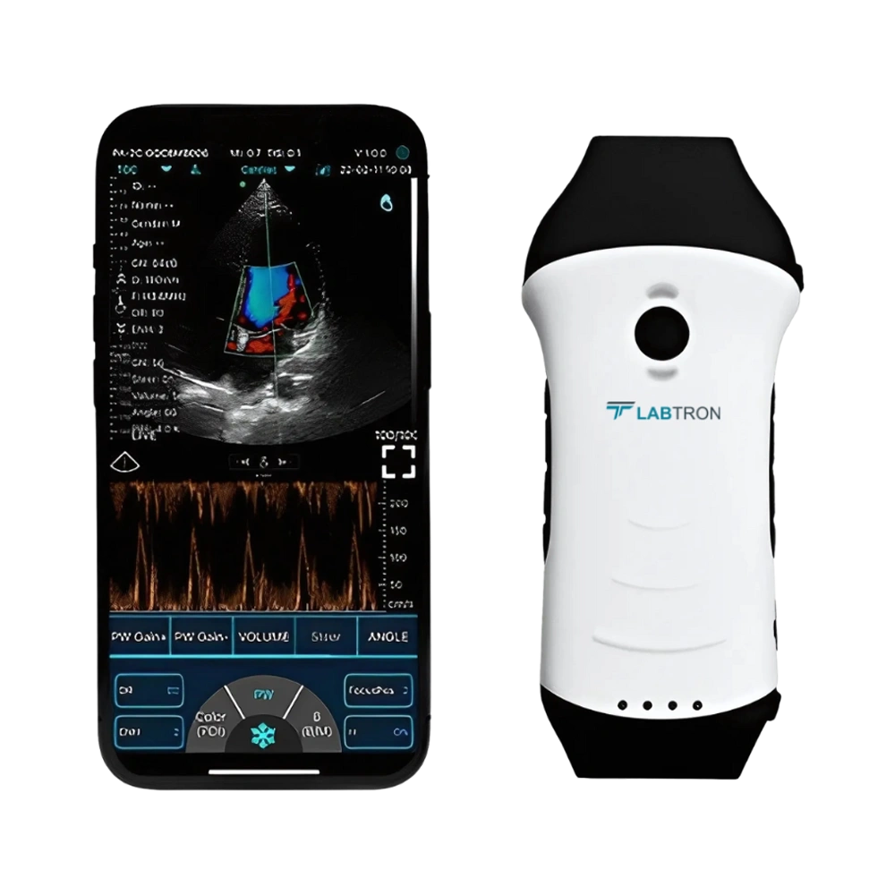 Portable Ultrasound Scanner LPUS-A11
