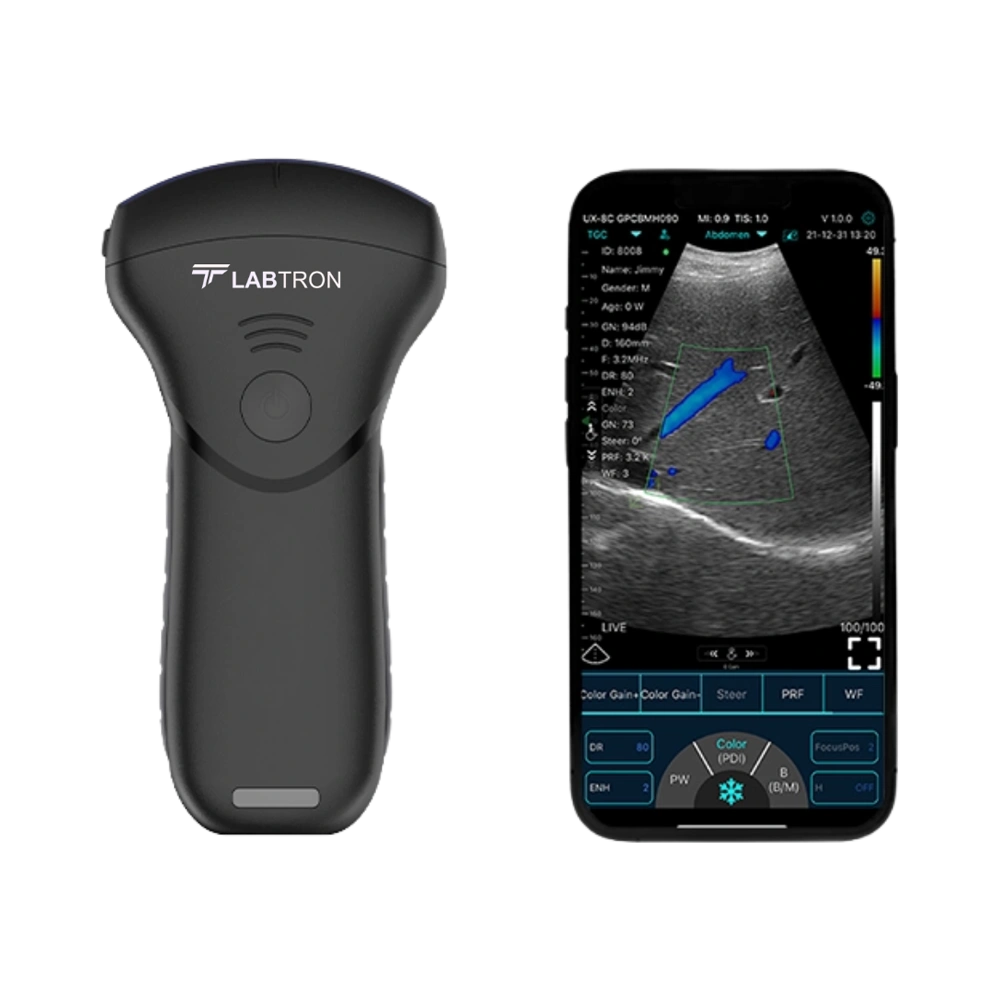 Portable Ultrasound Scanner LPUS-A12_Front view