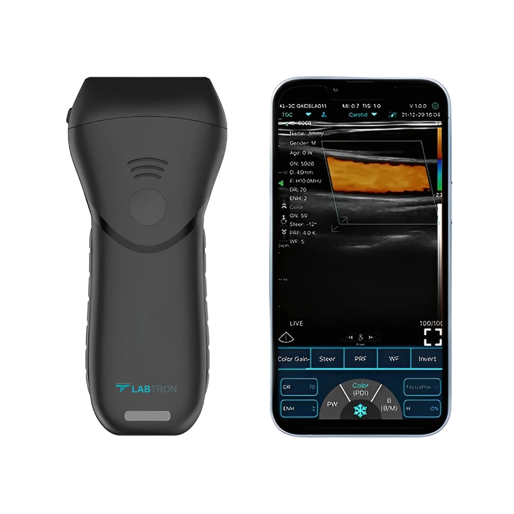 Portable Ultrasound Scanner LPUS-A16