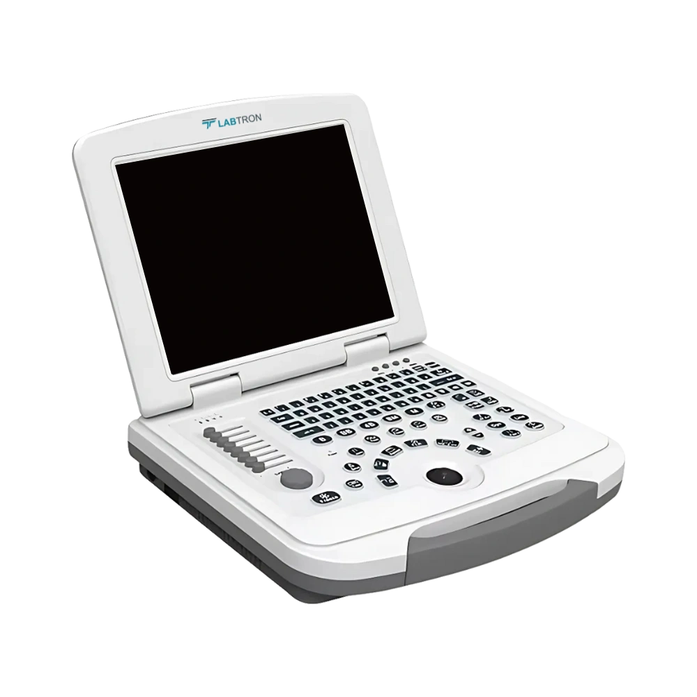 Portable Ultrasound Scanner LPUS-B10_Side View