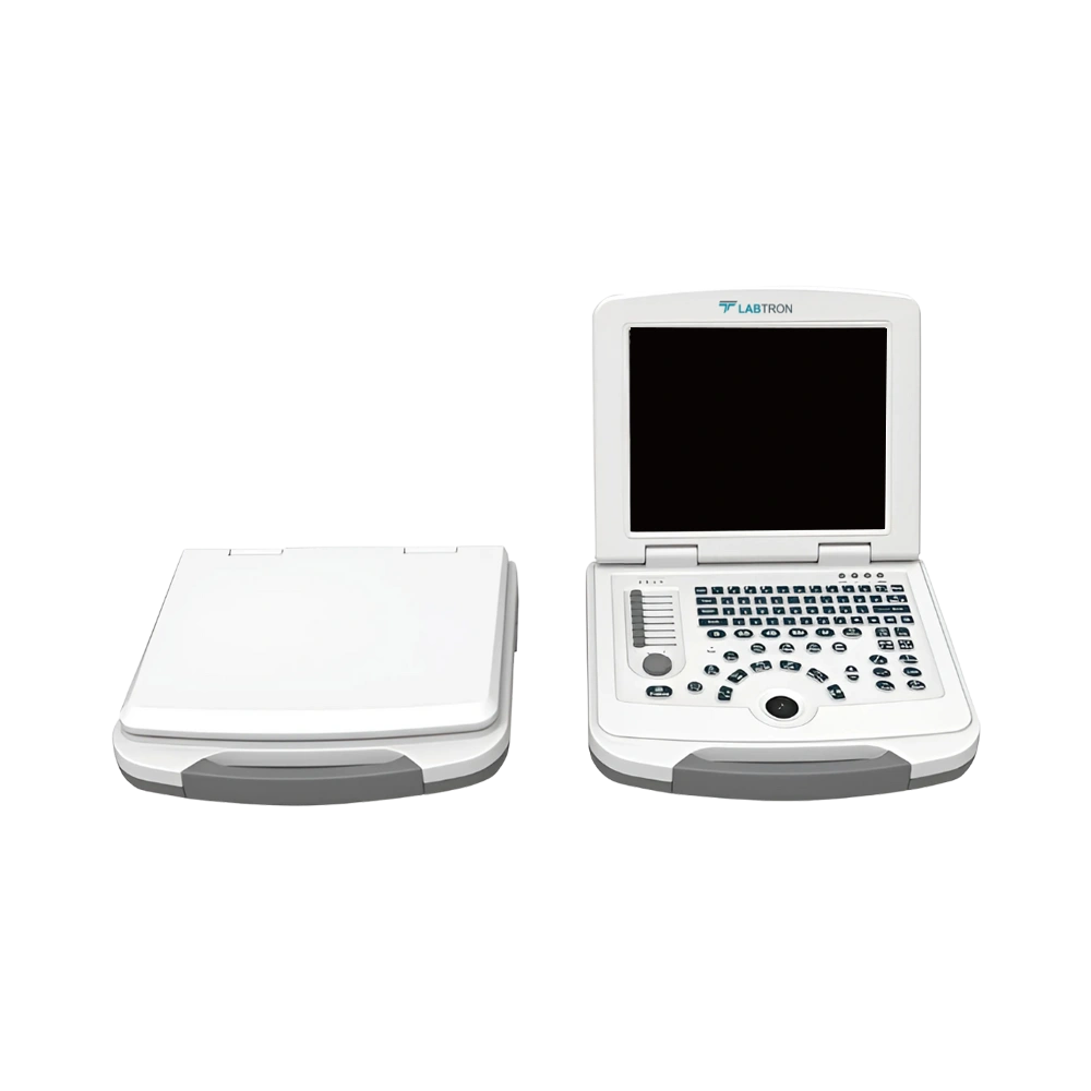Portable Ultrasound Scanner LPUS-B10_Front View
